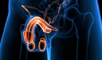 PENILE CANCER
