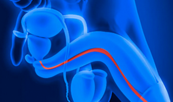 MEATAL STENOSIS