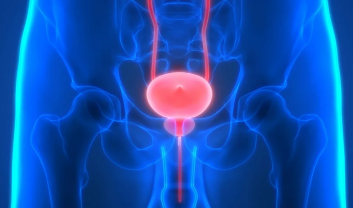 URINARY BLADDER STONE